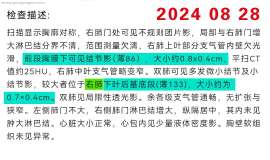 2023.8.29，穿刺活检确诊肺腺癌四期，不能手术。9月5日基因检测ALK融合突变。9月