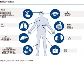 免疫治疗的副作用有何征兆？可以预防吗？（上）