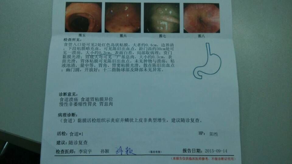 内窥镜报告