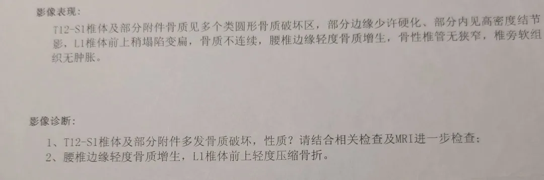 肺癌脑转移、骨转移，如今母亲也成功跨越10年了！